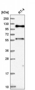 Anti-SPIDR antibody produced in rabbit 