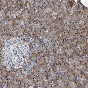Anti-SPINK1 antibody produced in rabbit 