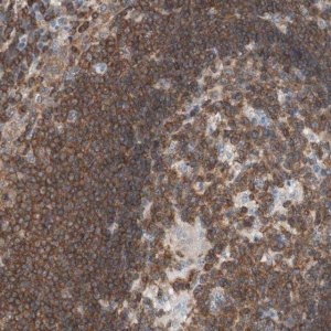 Anti-SPINK6 antibody produced in rabbit 