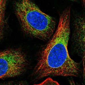 Anti-SPTLC1 antibody produced in rabbit 
