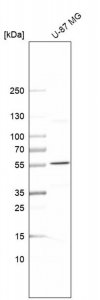 Anti-SPTLC3 antibody produced in rabbit 