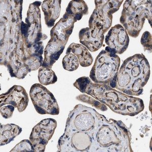 Anti-SQLE antibody produced in rabbit 