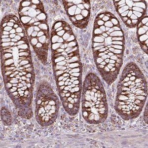 Anti-SQRDL antibody produced in rabbit 