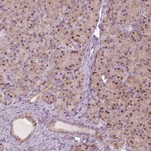 Anti-SQSTM1 antibody produced in rabbit 