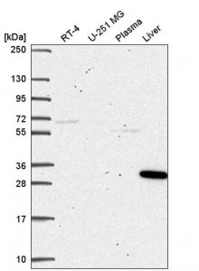 Anti-SQSTM1 antibody produced in rabbit HPA064165-100UL