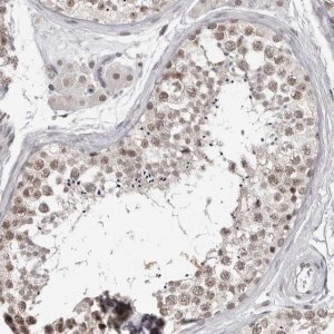 Anti-SRCAP antibody produced in rabbit 