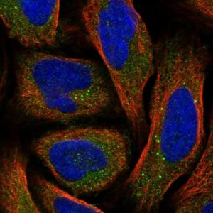 Anti-SRD5A3 antibody produced in rabbit 
