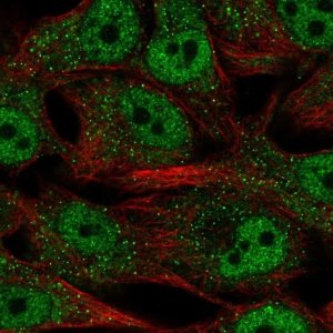 Anti-SREBF2 antibody produced in rabbit 
