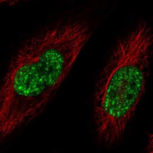 Anti-SREK1 antibody produced in rabbit 