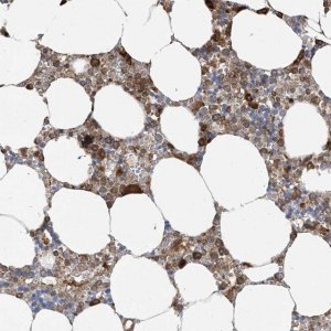 Anti-SRP72 antibody produced in rabbit 