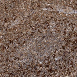 Anti-SRP72 antibody produced in rabbit 