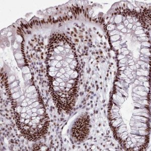 Anti-SRRM1 antibody produced in rabbit 