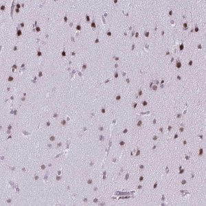 Anti-SS18 antibody produced in rabbit 