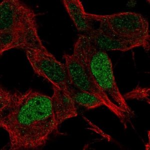 Anti-SSBP2 antibody produced in rabbit 