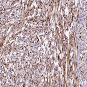 Anti-SSC5D antibody produced in rabbit 
