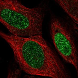 Anti-SSPN antibody produced in rabbit 