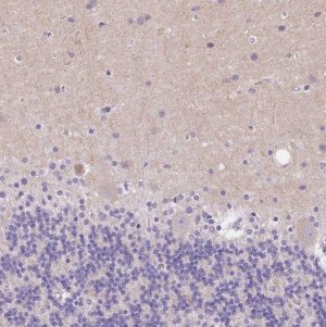 Anti-SSTR4 antibody produced in rabbit 