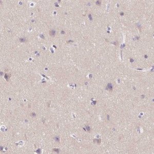 Anti-SSTR4 antibody produced in rabbit 