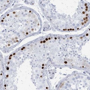 Anti-SSX2 antibody produced in rabbit 