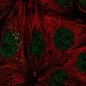 Anti-ST14 antibody produced in rabbit 