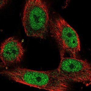 Anti-STAG1 antibody produced in rabbit 