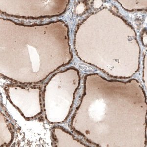 Anti-STC1 antibody produced in rabbit 