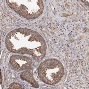 Anti-STEAP2 antibody produced in rabbit 