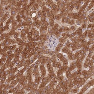 Anti-STEAP3 antibody produced in rabbit HPA050510-100UL