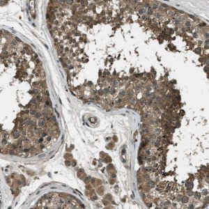 Anti-STK11 antibody produced in rabbit 