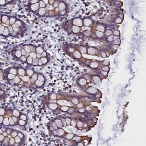 Anti-STK32A antibody produced in rabbit 