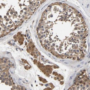 Anti-STK32C antibody produced in rabbit 