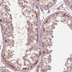 Anti-STK33 antibody produced in rabbit 