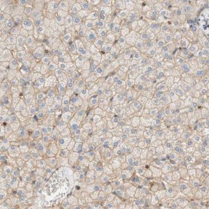Anti-STOM antibody produced in rabbit 