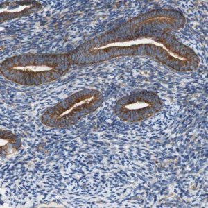Anti-STOM antibody produced in rabbit 
