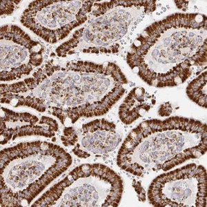 Anti-STOML2 antibody produced in rabbit 