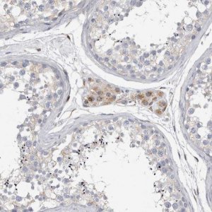 Anti-STRADB antibody produced in rabbit 