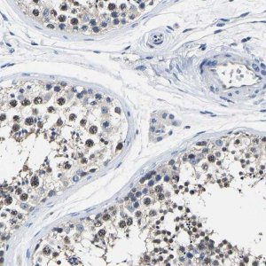 Anti-STRBP antibody produced in rabbit 