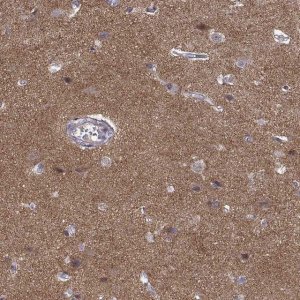 Anti-STRC antibody produced in rabbit 