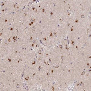 Anti-STX16 antibody produced in rabbit 
