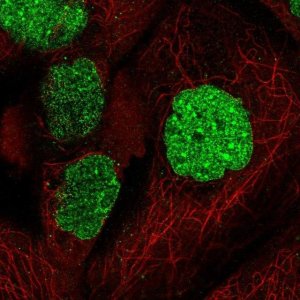 Anti-SUMO1 antibody produced in rabbit 