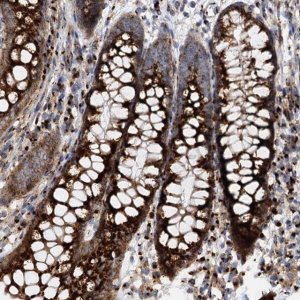 Anti-SUPT20H antibody produced in rabbit 
