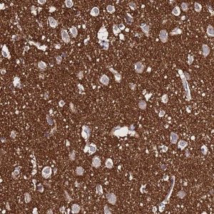 Anti-SV2B antibody produced in rabbit 
