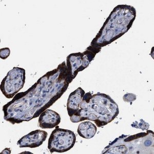 Anti-SVEP1 antibody produced in rabbit 