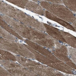 Anti-SVIL antibody produced in rabbit 