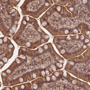 Anti-SYMPK antibody produced in rabbit 