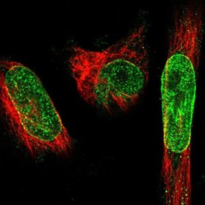 Anti-SYNE1 antibody produced in rabbit 