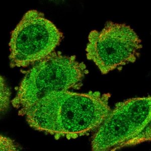 Anti-TACC2 antibody produced in rabbit 