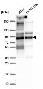 Anti-TACC2 antibody produced in rabbit 