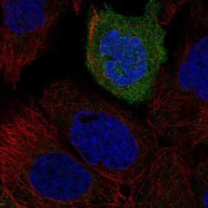 Anti-TACR2 antibody produced in rabbit 