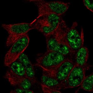 Anti-TADA2A antibody produced in rabbit 